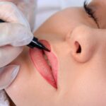 microlabios